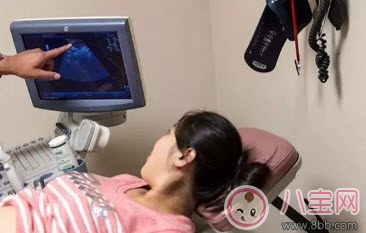 林心如愛吃甜食生女孩  懷孕如何測男女