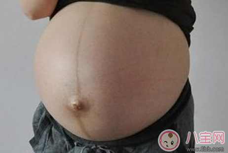 怎么通過妊娠紋判斷懷的是男是女 妊娠紋判斷性別方法 怎么通過妊娠紋判斷懷的是男是女 妊娠紋判斷性別方法