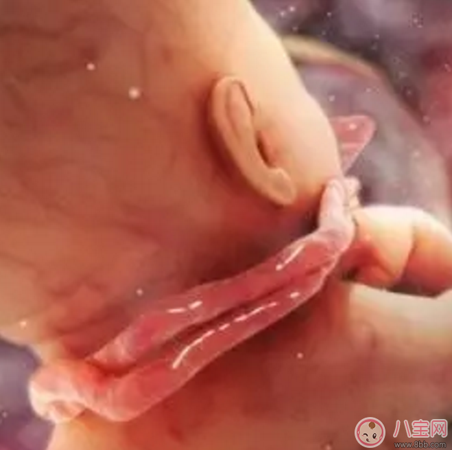 胎兒臍帶繞頸怎么辦？產(chǎn)前怎樣化解臍帶繞頸？