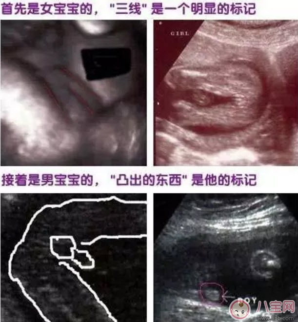 二胎生男生女早知道 第二胎生男生女早知道小妙招 二胎生男生女早知道 第二胎生男生女早知道小妙招