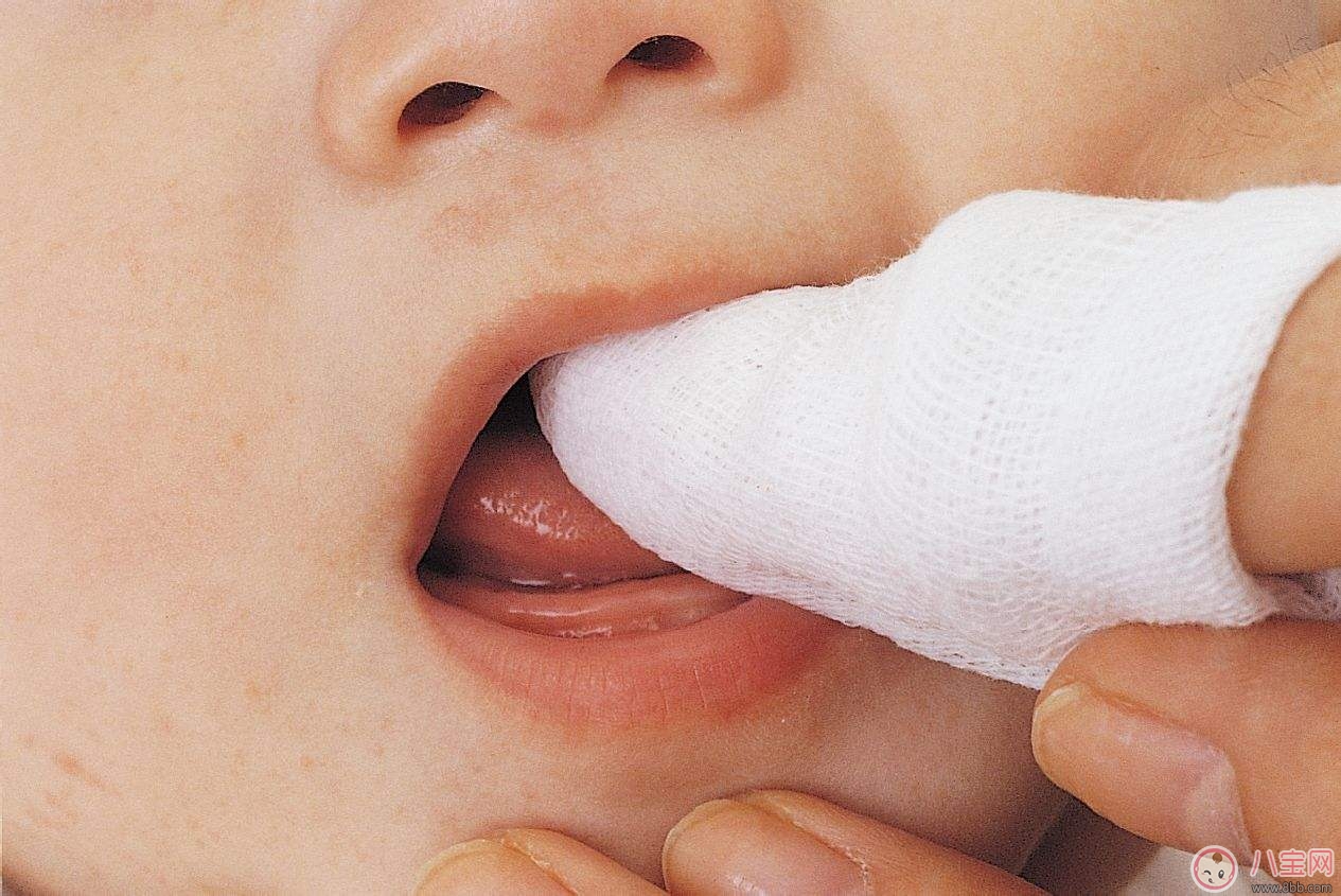母乳寶寶的牙齒保健 如何護理寶寶牙齒 母乳寶寶的牙齒保健 如何護理寶寶牙齒
