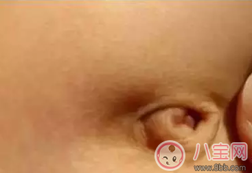 孩子肚臍臟了怎么辦 就算你有強迫癥也不能摳 孩子肚臍臟了怎么辦 就算你有強迫癥也不能摳