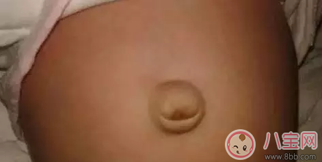 孩子肚臍臟了怎么辦 就算你有強迫癥也不能摳 孩子肚臍臟了怎么辦 就算你有強迫癥也不能摳