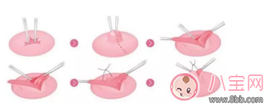 母乳喂養很艱難 別不小心走到坑里面去了 母乳喂養很艱難 別不小心走到坑里面去了