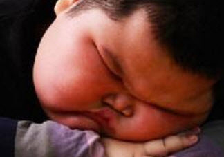 小孩肥胖的危害有哪些 2017兒童肥胖問題大全