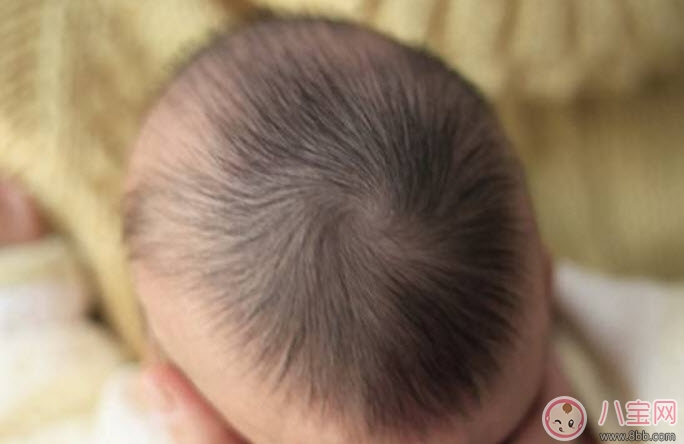 夏天寶寶出汗多是什么原因 寶寶出汗和虛汗的區別 夏天寶寶出汗多是什么原因 寶寶出汗和虛汗的區別