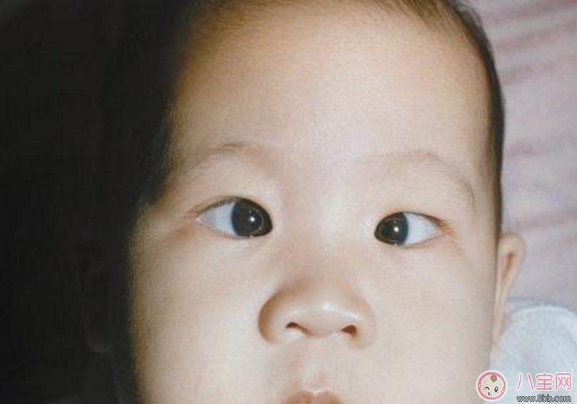 孩子內斜視怎么辦 怎么糾正孩子內斜視