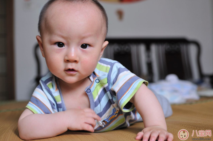 孩子內斜視怎么辦 怎么糾正孩子內斜視