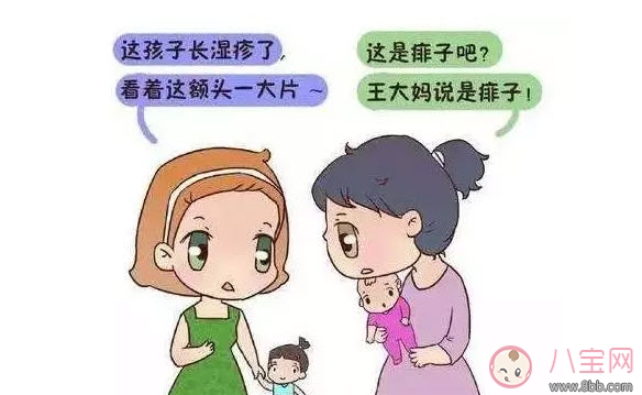 寶寶痱子和濕疹的區(qū)別 濕疹和痱子的區(qū)別圖片 寶寶痱子和濕疹的區(qū)別 濕疹和痱子的區(qū)別圖片