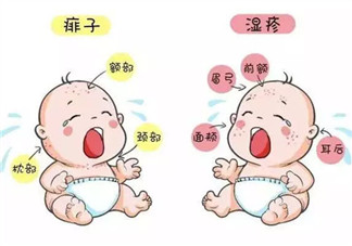 寶寶痱子和濕疹的區別 濕疹和痱子的區別圖片