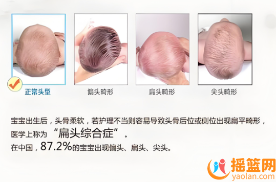 寶寶后腦勺扁平？如何將頭變圓呢？